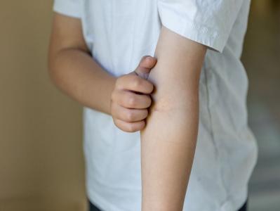 child scratching arm itching skin infection rash